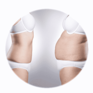 Karcsúsító testápolás